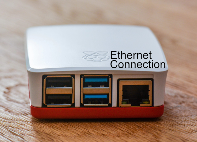 SonoPlus Ethernet
